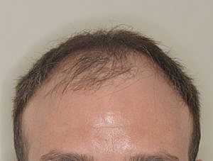 Patient Before