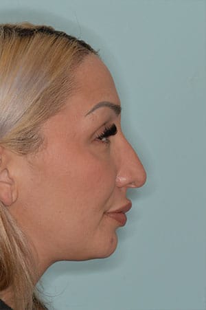 Patient Before