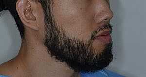 Patient After