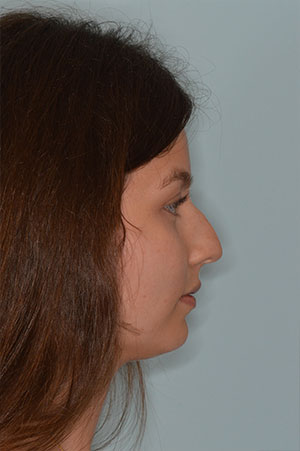 Patient Before