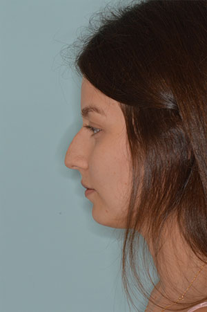 Patient Before