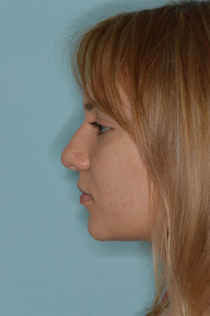 Patient Before