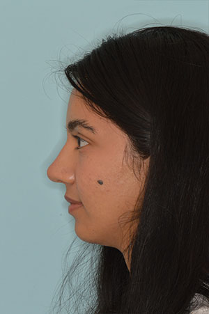 Patient After