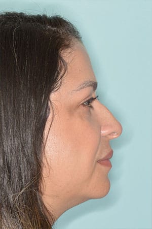 Patient Before