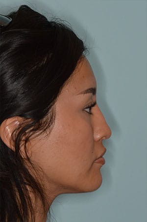 Patient Before