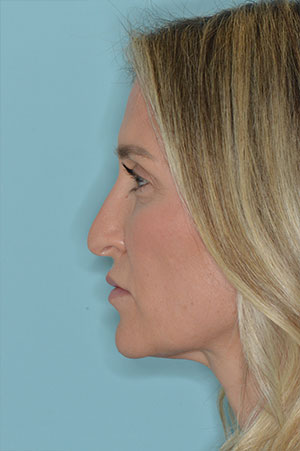 Patient Before
