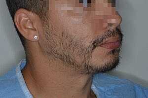 Patient Before